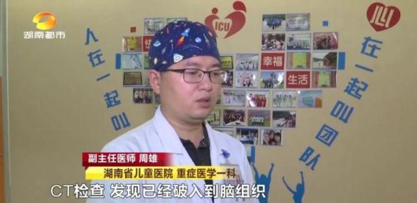 揪心！6岁女孩遭筷子戳眼，直插大脑9cm！事发时家长就在身边……