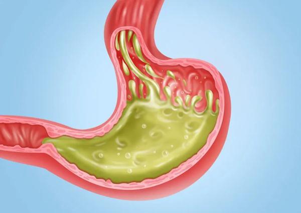 【食疗养生】总是反酸、烧心，试试这几道食疗