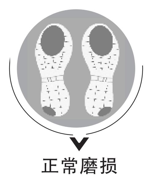 看鞋底,查疾病!鞋底有4种磨损一定要注意! 看鞋底,查疾病!鞋底有4种磨损一定要注意!
