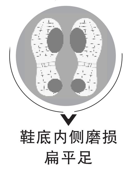 看鞋底,查疾病!鞋底有4种磨损一定要注意! 看鞋底,查疾病!鞋底有4种磨损一定要注意!