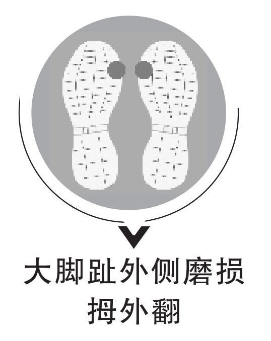 看鞋底,查疾病!鞋底有4种磨损一定要注意! 看鞋底,查疾病!鞋底有4种磨损一定要注意!