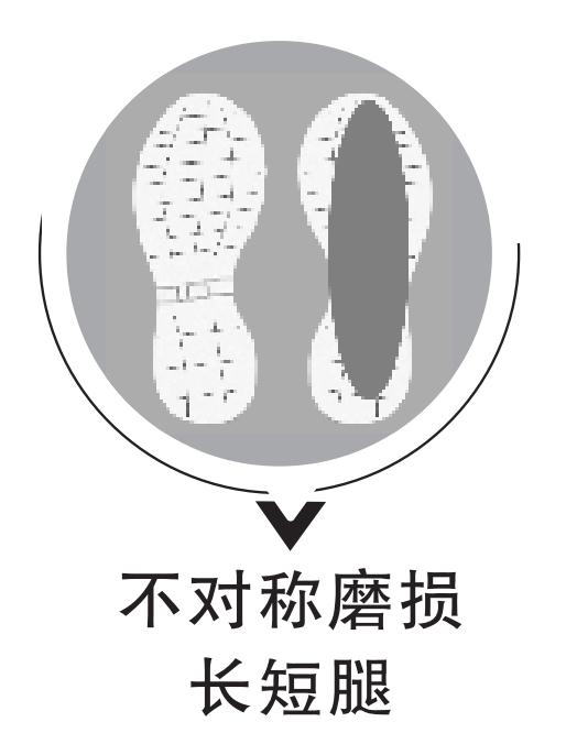 看鞋底,查疾病!鞋底有4种磨损一定要注意! 看鞋底,查疾病!鞋底有4种磨损一定要注意!