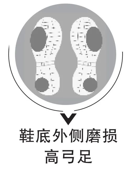 看鞋底,查疾病!鞋底有4种磨损一定要注意! 看鞋底,查疾病!鞋底有4种磨损一定要注意!