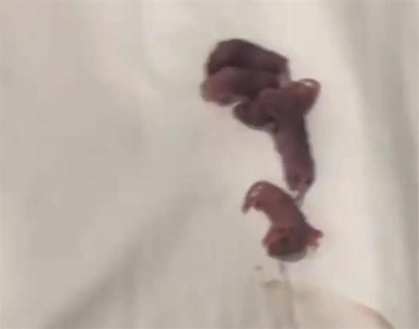 酒店枕头下发现……住客被恶心到睡不着 酒店枕头下发现……住客被恶心到睡不着