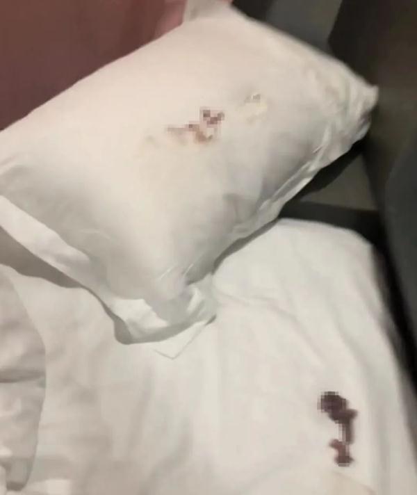 吓懵!男子入住酒店发现枕头下一窝老鼠幼崽,还被他压死了… 吓懵!男子入住酒店发现枕头下一窝老鼠幼崽,还被他压死了…