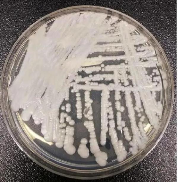 这种“超级真菌”传播速度惊人,华南地区并不少见!专家提醒→ 这种“超级真菌”传播速度惊人,华南地区并不少见!专家提醒→