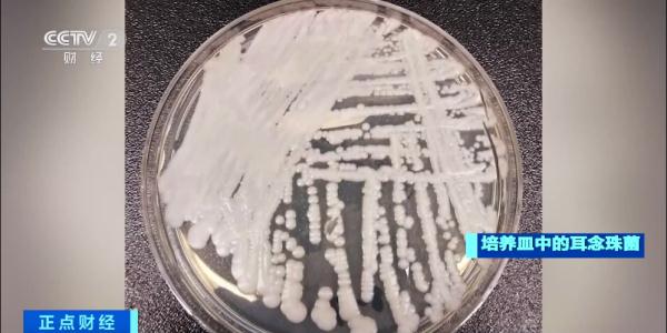 致命真菌在美国蔓延！三分之一感染者死亡