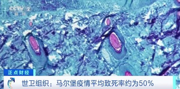 世卫组织发声！再次报告确诊病例！这一病毒平均致死率达50%