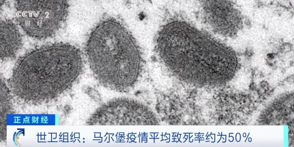 世卫组织发声！再次报告确诊病例！这一病毒平均致死率达50%