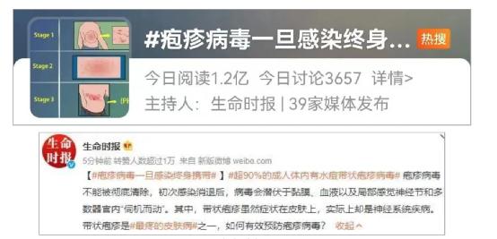“衣服摩擦都觉得痛！”超90%成人体内都潜伏这病毒，一旦感染终身携带！