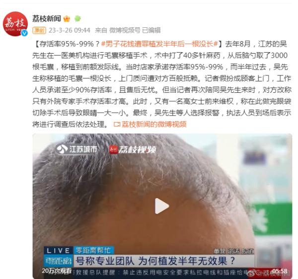 存活率95%至99%？男子花钱遭罪植发半年后一根没长