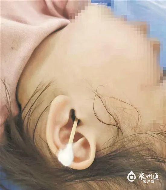 家长请注意！两岁娃一个举动致鼓膜穿孔，医生提醒……