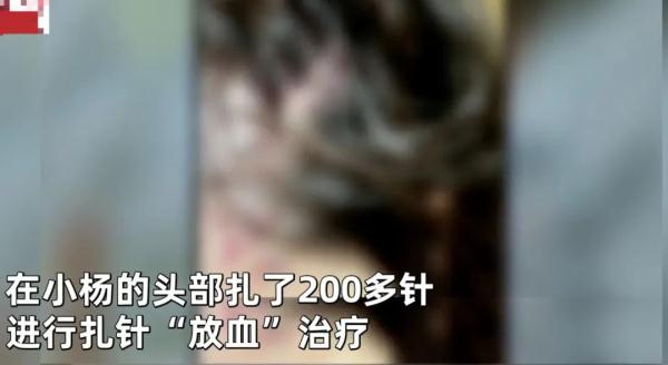 空姐注射玻尿酸险丧命，想做医美的注意了！