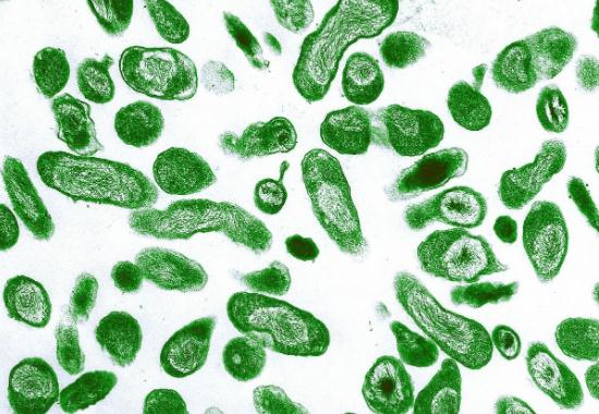 【健康资讯】紧急提醒！已有人住院！一种人畜共患病来袭......