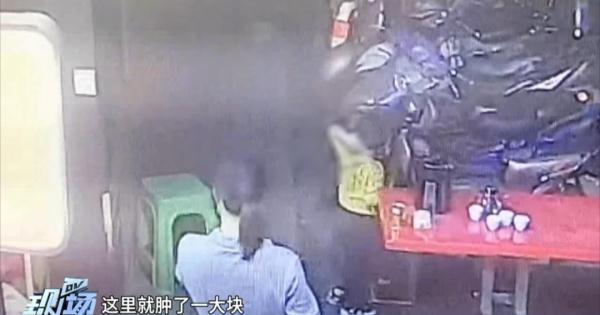 嫌吵！男子往楼下扔水瓶，小孩脖子被砸肿渗血，警方回应