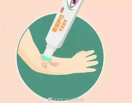 烧伤烫伤后家庭护理应该怎么做？