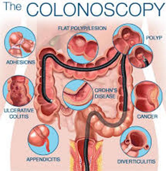 一年6次手术，一代传奇离世！这种病能早诊早治吗？