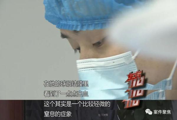 8旬老人猝然离世,脸上印记揭开死因!谁最可疑? 8旬老人猝然离世,脸上印记揭开死因!谁最可疑?