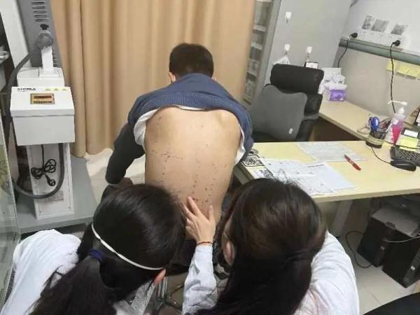 一到春天就过敏？上海人最主要的过敏原不是花粉，竟是这三种！