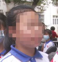 听说现在小学生流行“盘它”？医生：当心“盘”出病!