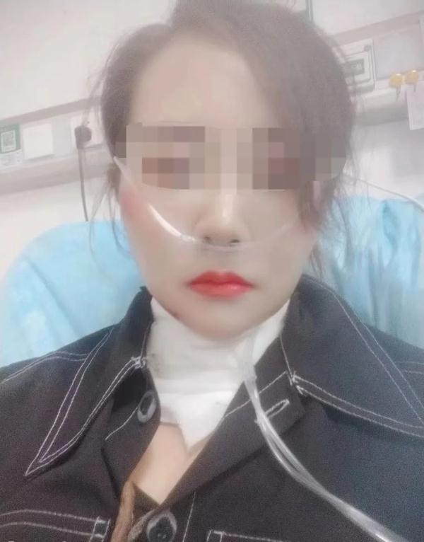 风筝线横跨两树间 一女子颈部被割伤