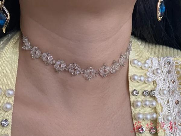 风筝线横跨两树间 一女子颈部被割伤