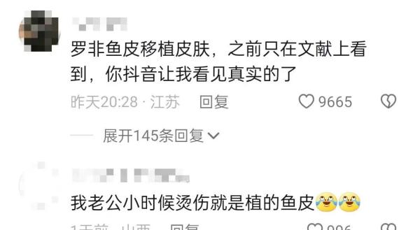 冲上热搜!女子为救助被剥皮的流浪猫,花2万给猫植鱼皮 冲上热搜!女子为救助被剥皮的流浪猫,花2万给猫植鱼皮