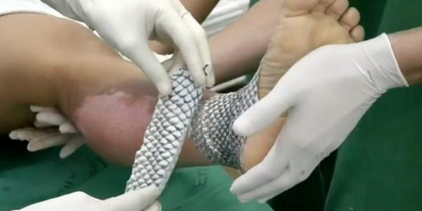 冲上热搜!女子为救助被剥皮的流浪猫,花2万给猫植鱼皮 冲上热搜!女子为救助被剥皮的流浪猫,花2万给猫植鱼皮