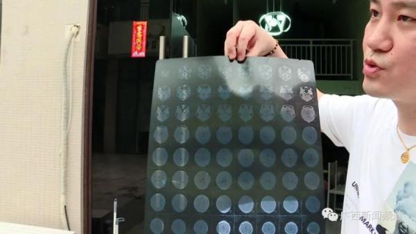 因漏水问题起冲突,男子被打成脑震荡 因漏水问题起冲突,男子被打成脑震荡