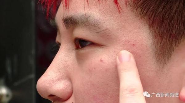 因漏水问题起冲突,男子被打成脑震荡 因漏水问题起冲突,男子被打成脑震荡