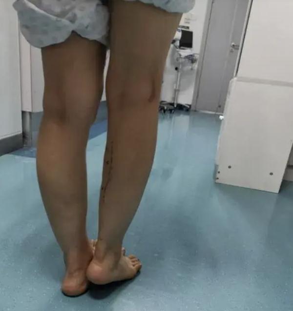 紧急提醒!19岁女孩住进ICU 紧急提醒!19岁女孩住进ICU