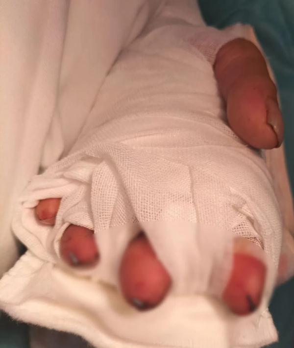 太可怕!厦门一面馆老板3根手指被切断!只因…… 太可怕!厦门一面馆老板3根手指被切断!只因……