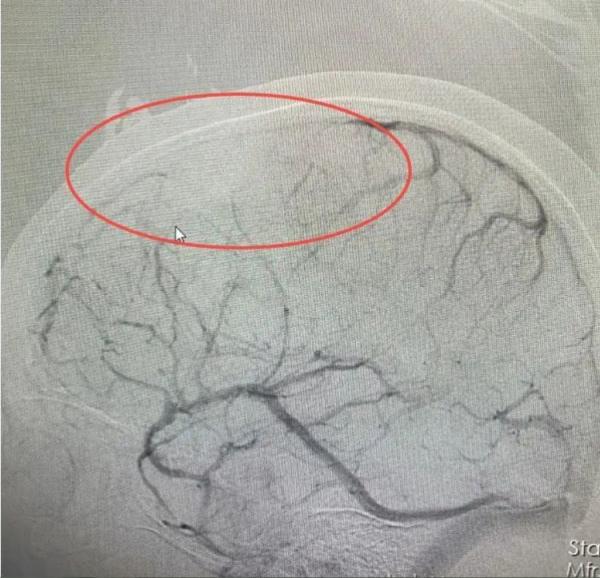 25岁女主播昏迷不醒!这些习惯不少人都有…… 25岁女主播昏迷不醒!这些习惯不少人都有……