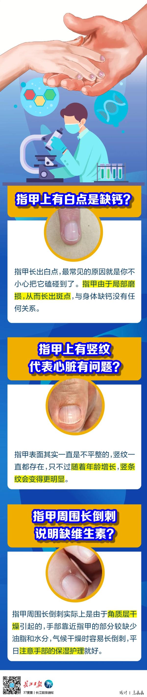 指甲有竖纹,就是不健康?有这7个变化的人要当心 指甲有竖纹,就是不健康?有这7个变化的人要当心