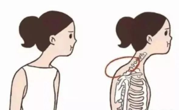 “富贵包”并不富贵 “富贵包”并不富贵