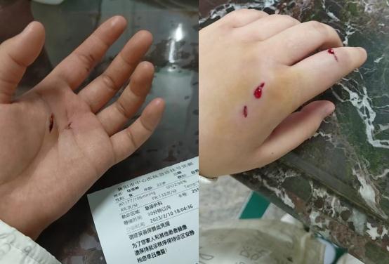 好疼!担心的事还是发生了! 好疼!担心的事还是发生了!