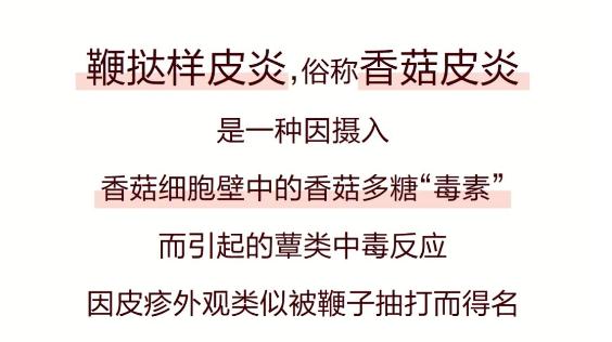 一顿烧烤后女子全身遍布“鞭痕”,竟是因为…医生提醒:熟透再吃 一顿烧烤后女子全身遍布“鞭痕”,竟是因为…医生提醒:熟透再吃