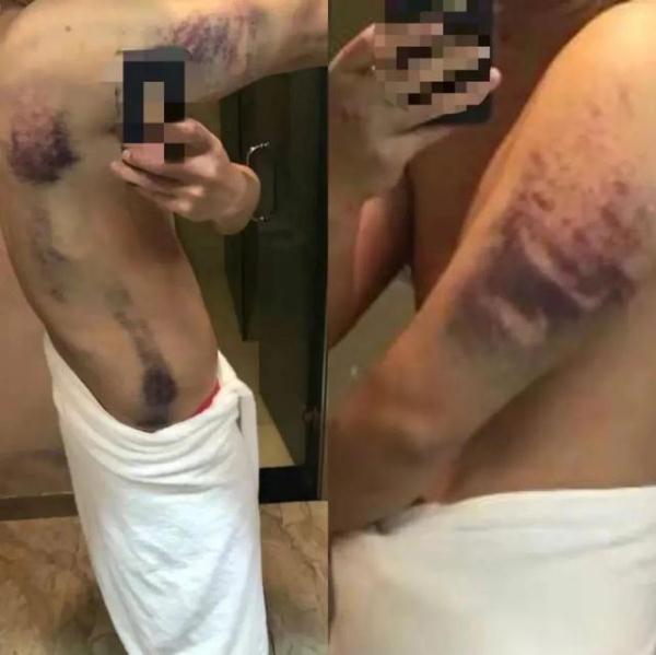 “高薪”是假，“深渊”是真！小伙亲述缅北脱险经历