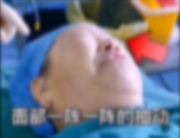“眼皮跳”没重视,结果半边脸都…… “眼皮跳”没重视,结果半边脸都……