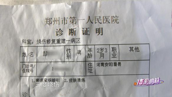 心疼！10个月大婴儿被开水烫伤，所幸…