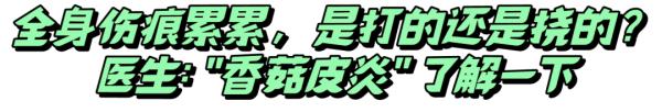 一顿烧烤后，女子全身似遭“鞭打”，竟是因为这种常见的食物？