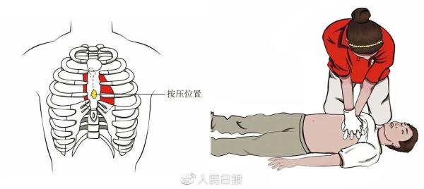 关键时刻能“救命”!常用急救知识合集 关键时刻能“救命”!常用急救知识合集