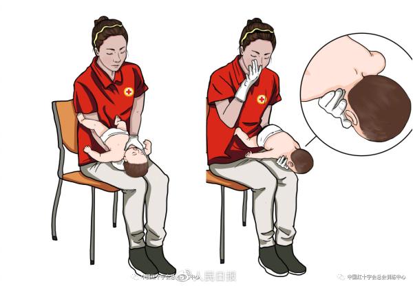 关键时刻能“救命”!常用急救知识合集 关键时刻能“救命”!常用急救知识合集