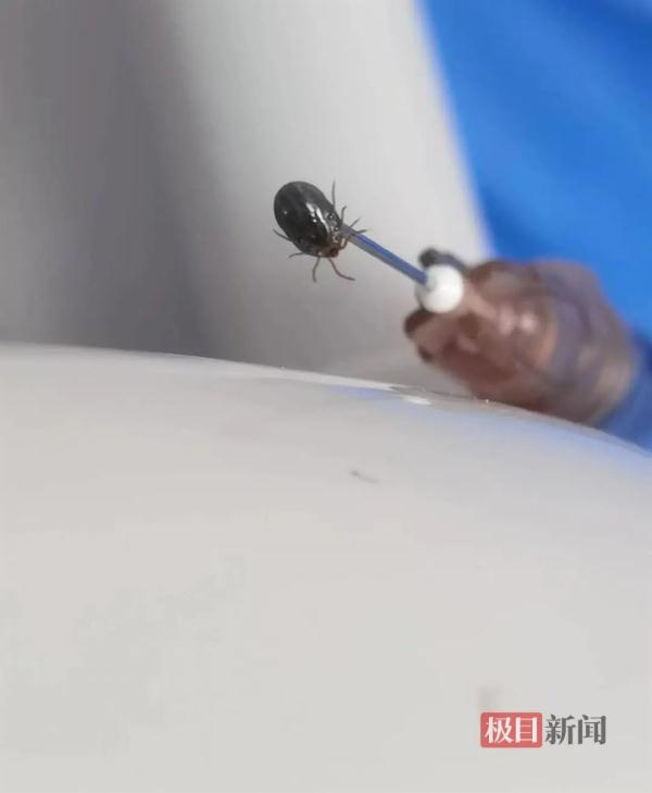 户外踏青后，女子小腿上惊现“黑痣”！医生紧急提醒