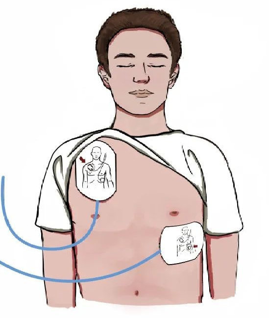 关键时刻能“救命”!常用急救知识合集 关键时刻能“救命”!常用急救知识合集