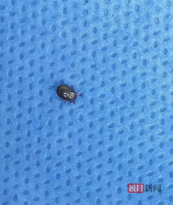 户外踏青后，女子小腿上惊现“黑痣”！医生紧急提醒