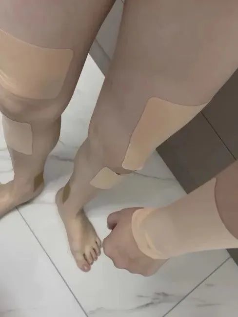 痛到睡不着！女子突发疾病性情大变，原来是......