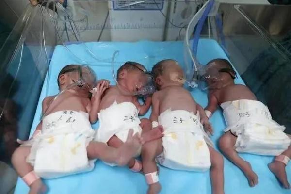 刚生完四胞胎又怀上四胞胎 刚生完四胞胎又怀上四胞胎