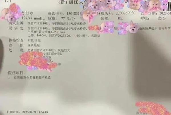 刚生完四胞胎又怀上四胞胎 刚生完四胞胎又怀上四胞胎