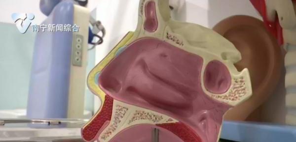 “腺样体面容”登热搜!孩子打鼾家长应注意 “腺样体面容”登热搜!孩子打鼾家长应注意